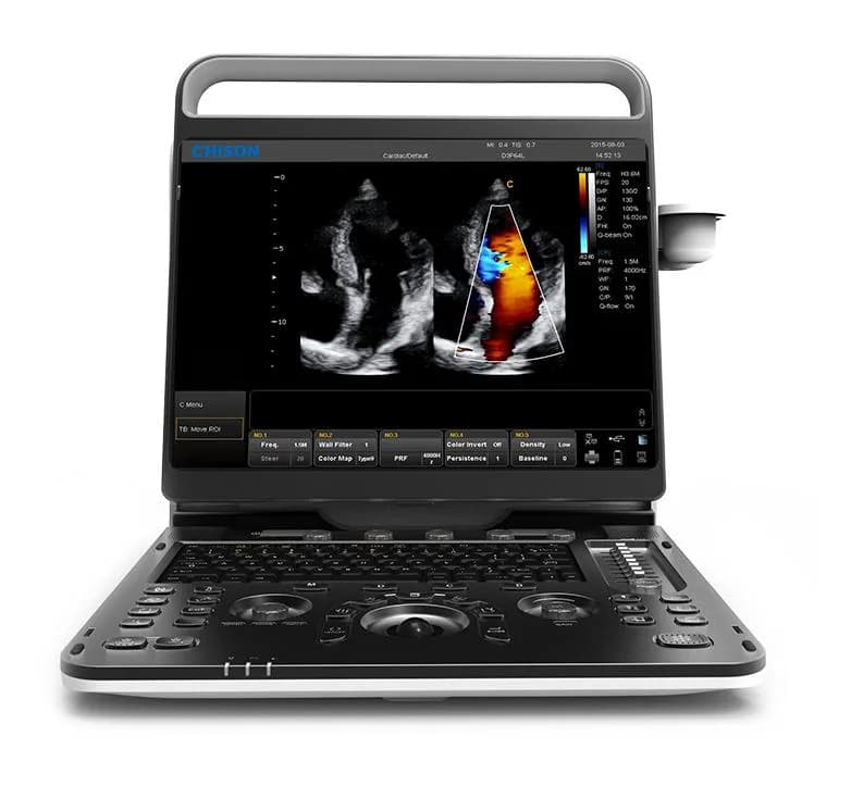 CHISON EBit 60 (SonoTouch 60) — уЗИ аппарат