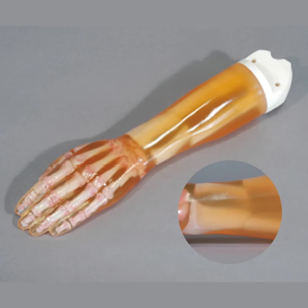 Ref. 41350-000-11 Fractured Hand/Forearm Phantom — фантом для имитации перелома руки/предплечья