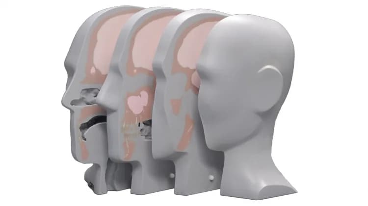 Ref. 731-HN Proton Therapy Dosimetry Head — фДПТ Фантом головы для дозиметрии протонной терапии
